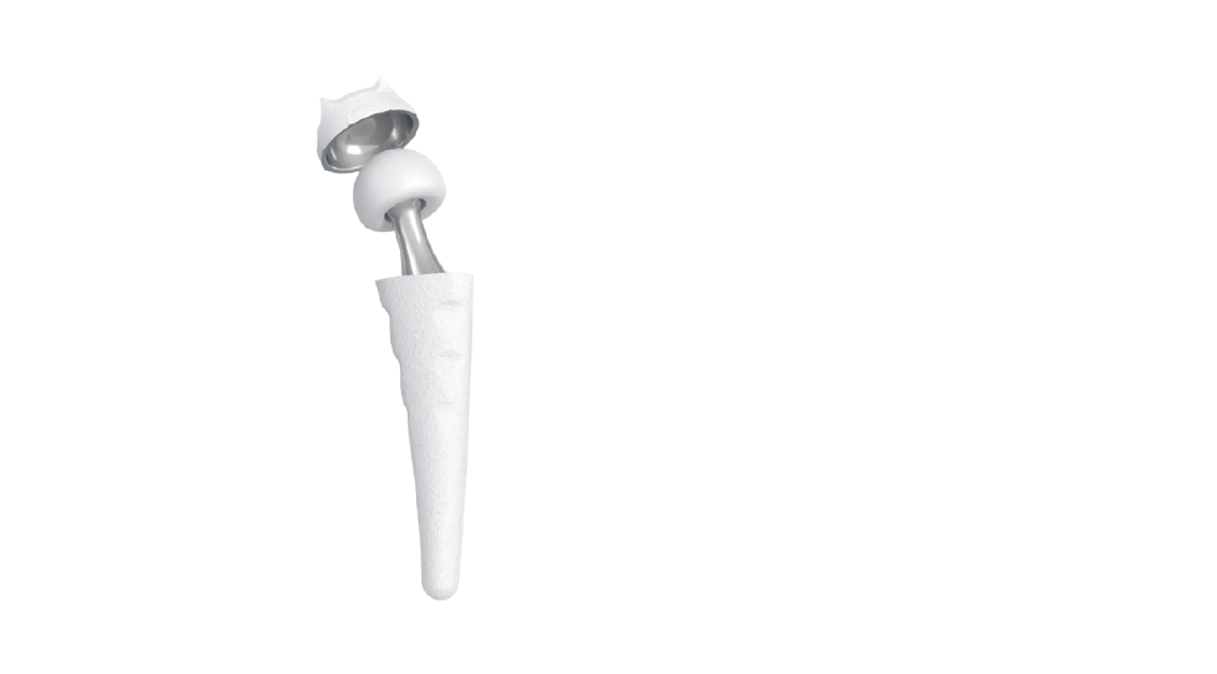 MAIA Carpometacarpal Prosthesis
