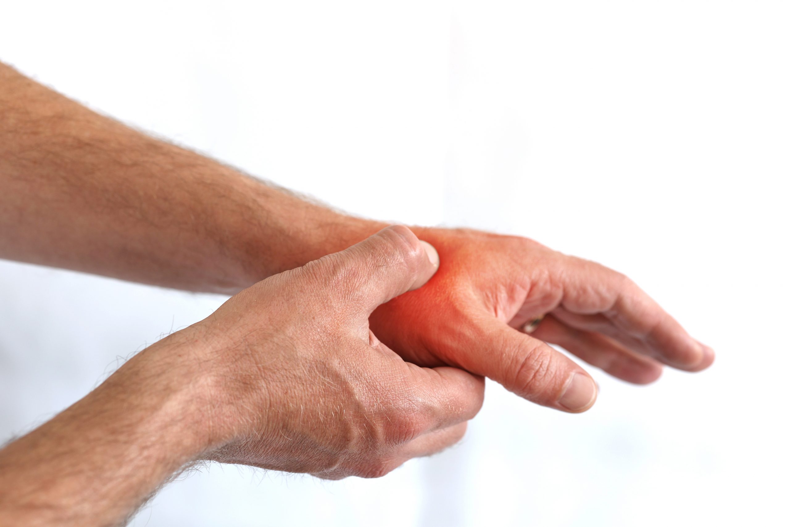 Person holding the base of their thumb with redness around the area.