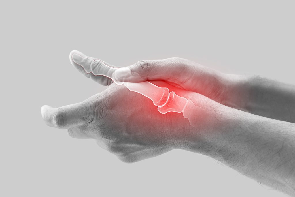 Hand and wrist, showing internal bone structure at the base of the thumb.