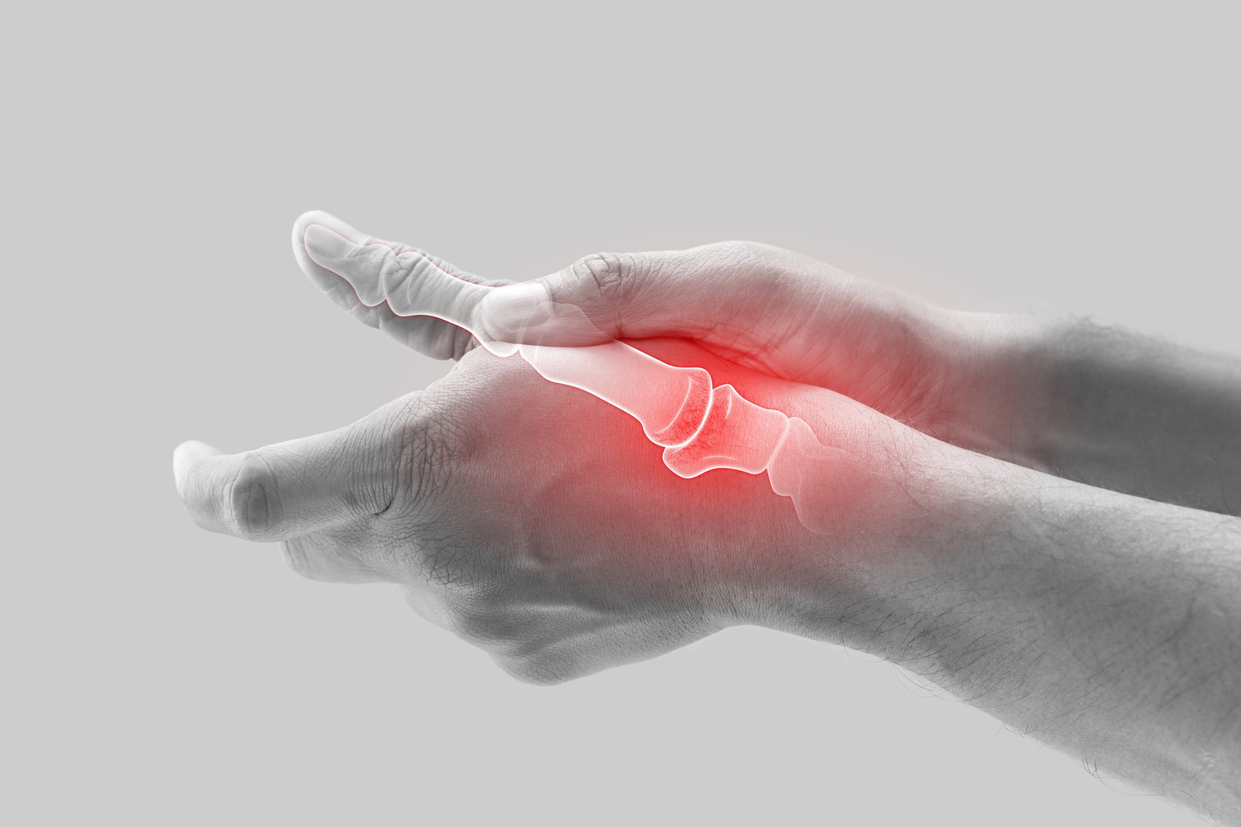 Understanding basal thumb osteoarthritis