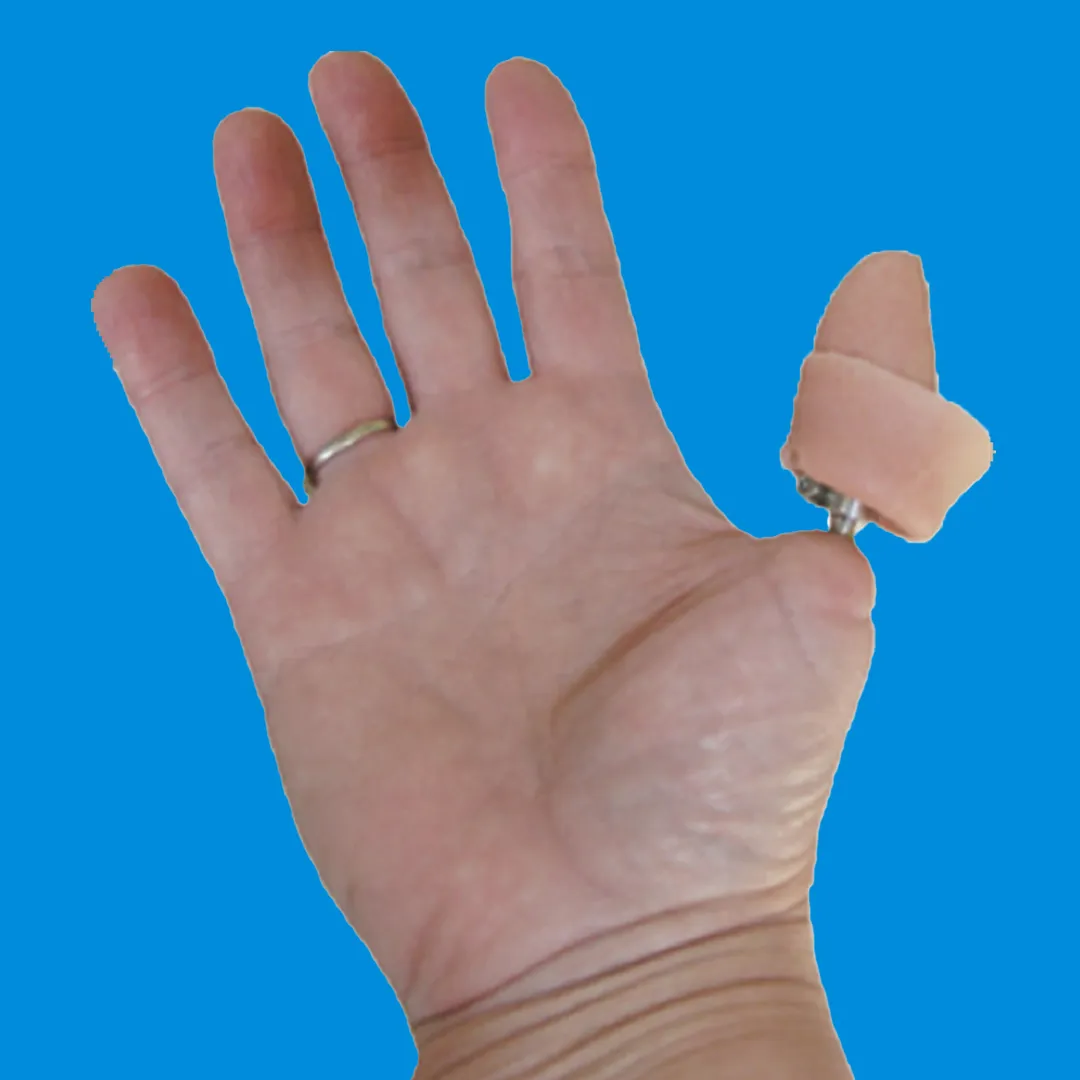 Integrum Osseointegration - thumb implants