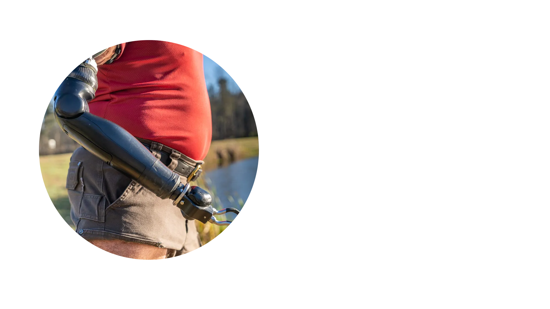 Osseointegration prosthetic arm