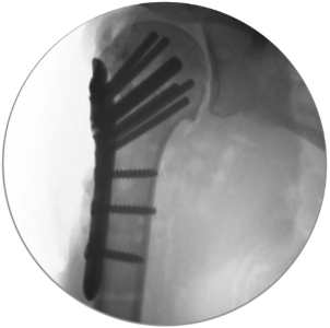 Anatomic Accommodation