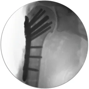 Anatomic Accommodation